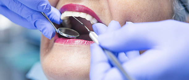 Best Walk-In Emergency Dental Services in Pleasant Hills, OH